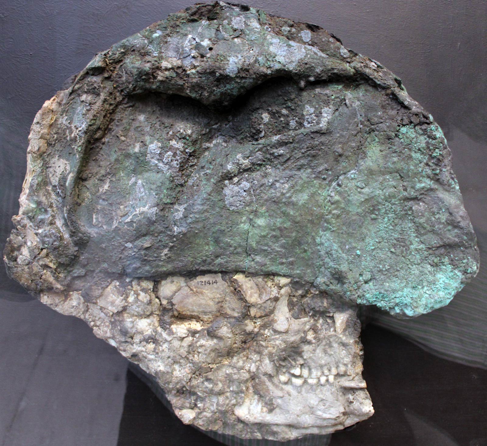 اور - اسکلت سر